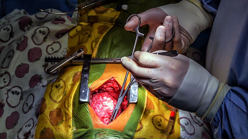 Ross Process Making a Comeback in Aortic Valve Illness