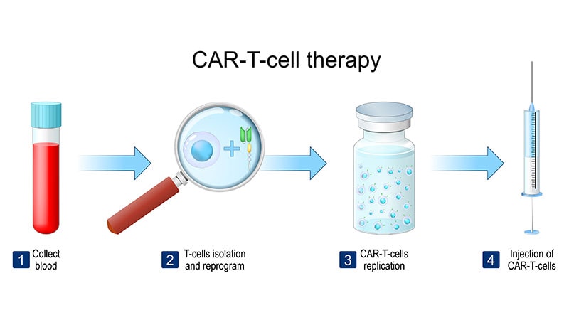 Promise for CAR T-Cell Therapies in Solid Tumors?