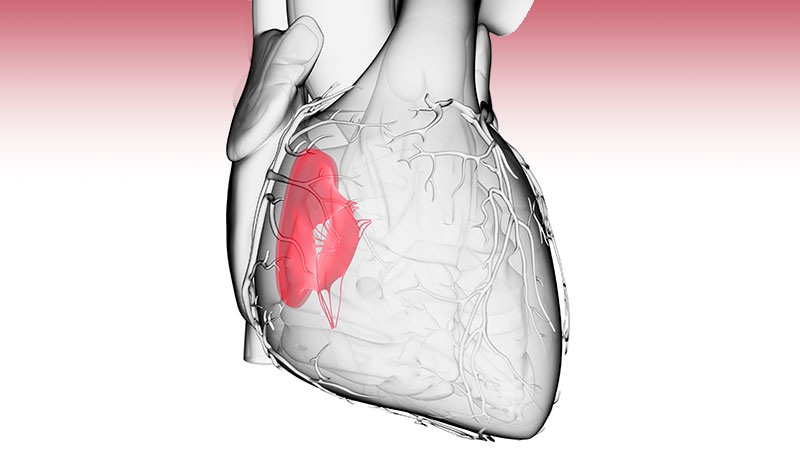 Rethinking the Timing of Tricuspid Valve Repairs