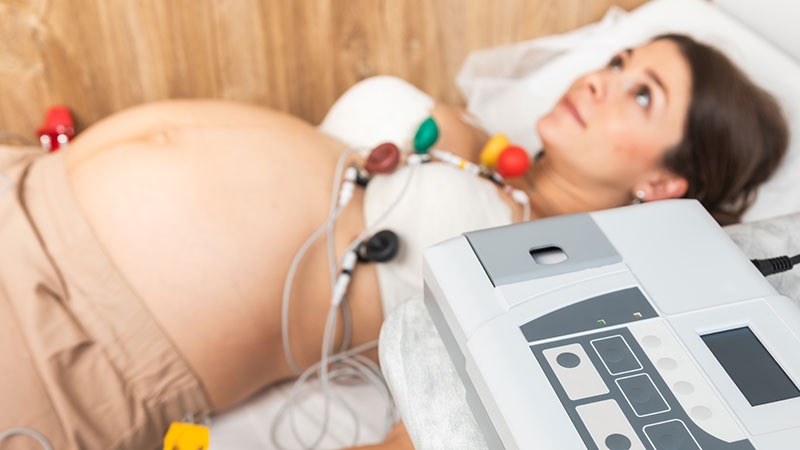 The Cardio-obstetrics Approach to Maternal CVD Risk