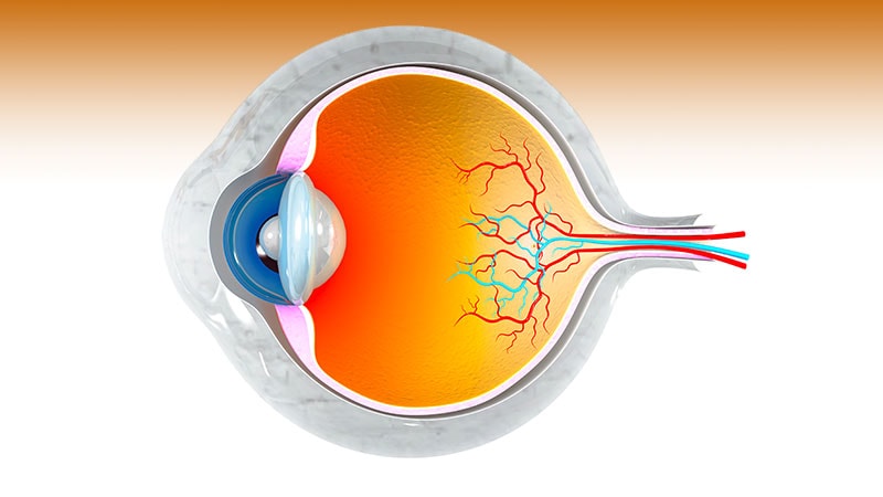 FDA OKs First Gene Therapy Implant for a Rare Eye Disease