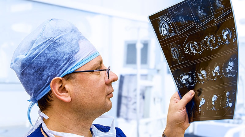 AI Model Detects Early Pancreatic Cancer on CT Scans