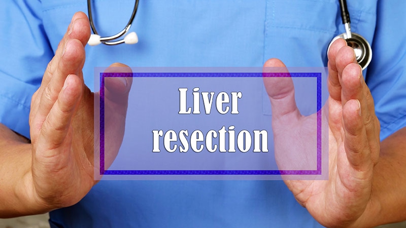 Laparoscopic Liver Resection Can Speed Patient Recovery Time