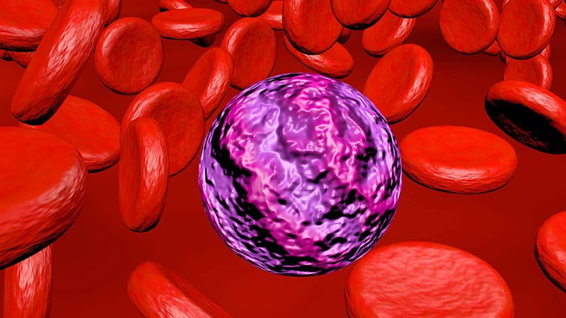 Measurable Residual Disease Predicts Real-World AML Relapse