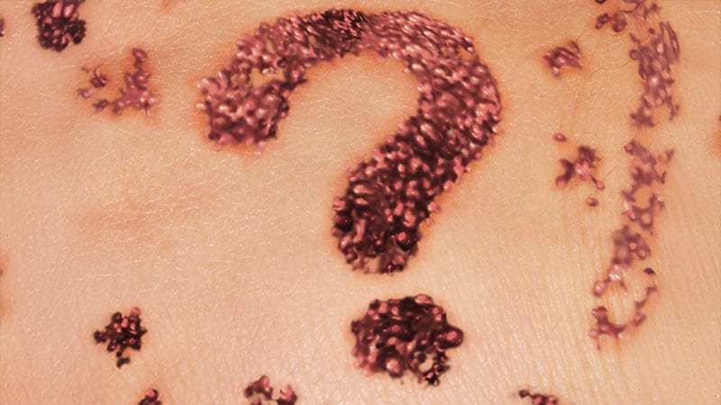 Population vs Tailored Skin Cancer Screening: Which Is Best?