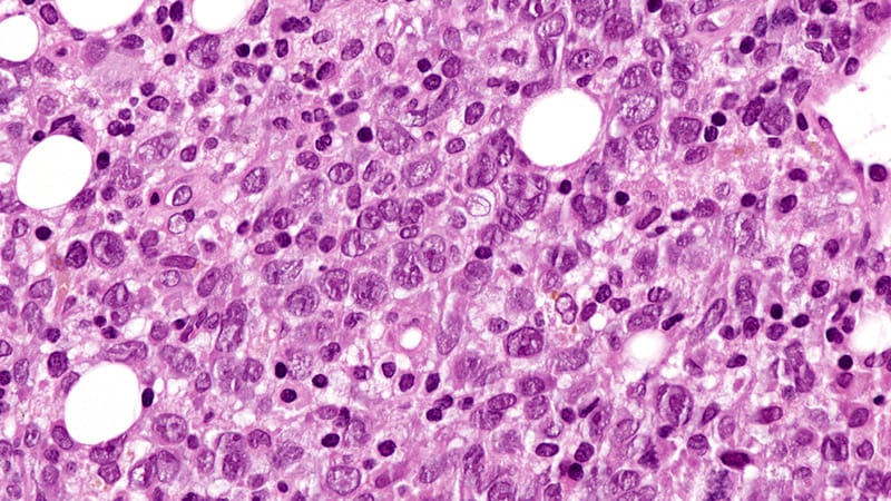 Can Two Targets Better Fight B-Cell Lymphoma?