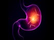 photo of Helicobacter pylori is a gram-negative, flagellated, helical bacterium