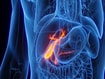 photo of Gallbladder