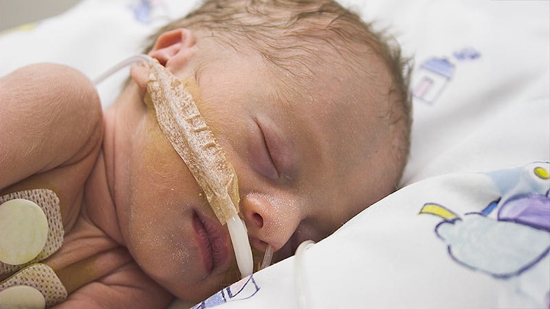 Air Pollution: A Risk Factor for Infant Bronchiolitis