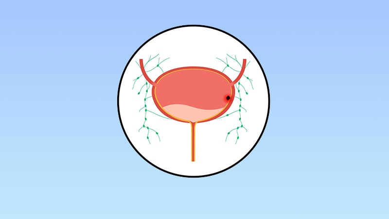 FDA Questions Single-Arm Studies for Cancer Approvals