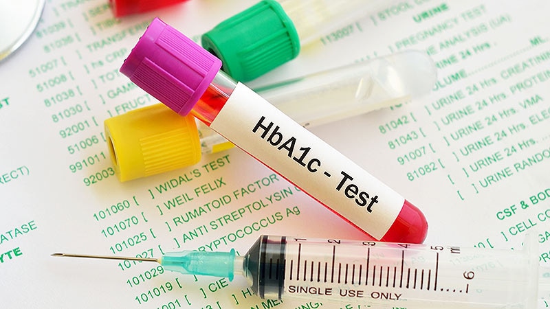 Is POC A1c Testing Optimized for Diabetes Screening?