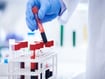photo of test tube filled with blood