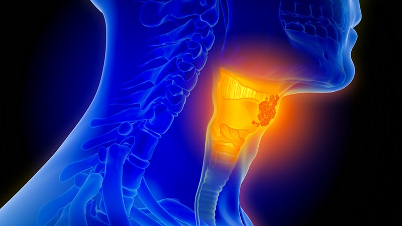Perioperative Pembro Approved to Up Chance of HNSCC Cure