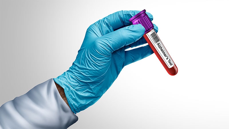Alzheimer’s Disease Leaves Signature in Blood and CSF