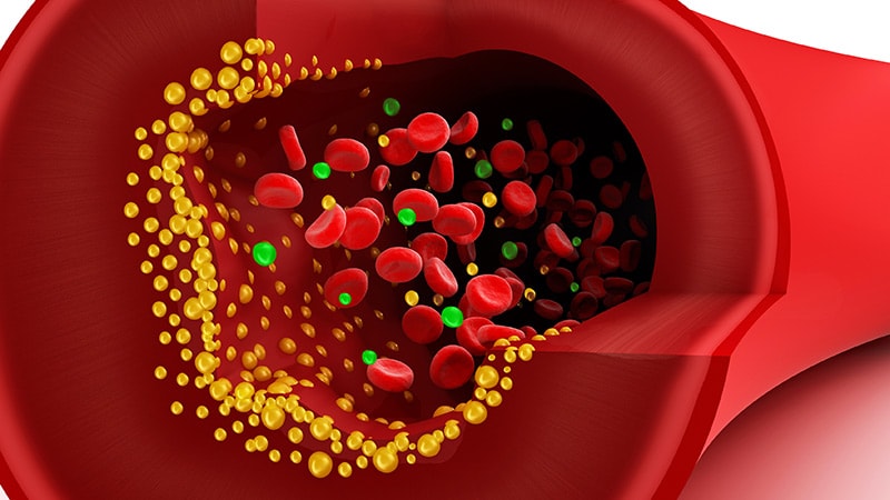 Is This Drug a Statin Alternative?