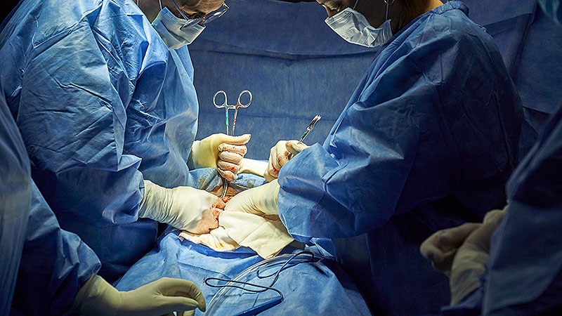 Local Anesthesia Pain: A Predictor of Post-Cesarean Pain?