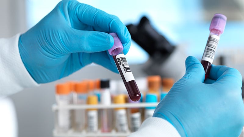 Insulin Resistance Linked to Faster Cognitive Decline in AD
