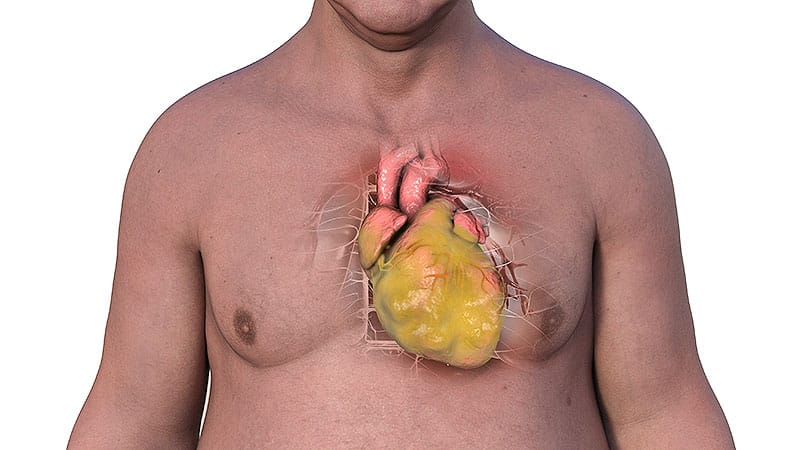 High Fat Around Heart Signals Risk for New AF
