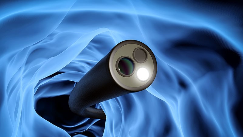 Combining Upper-Lower GI Screening Feasible, Effective