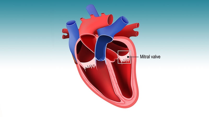 Early Mortality After Mitral Valve Surgery Higher in Women