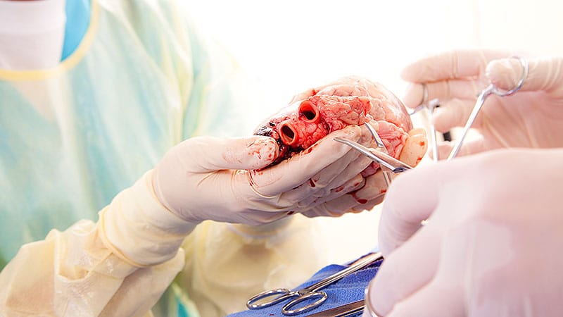 Women Less Likely to Receive Heart Transplant Yet Achieve Better Survival Outcomes