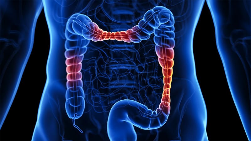 Gut Cells That Can Combat IBD