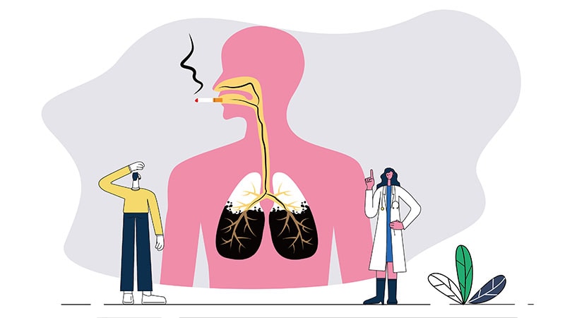 GPs Play a Key Role in Tobacco Control — in Just 1 Minute – Medscape