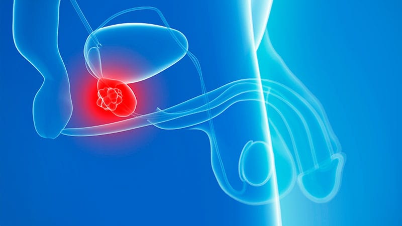 FDA Approves Niraparib-Abiraterone Acetate Combo for CSPC