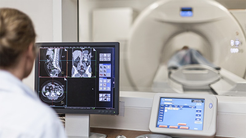 Can Dual-Energy CT Replace Standard Imaging in GI Bleeding?