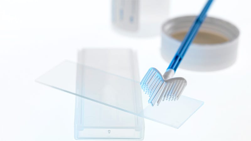 HPV Self-Sampling May Boost Cervical Cancer Screening