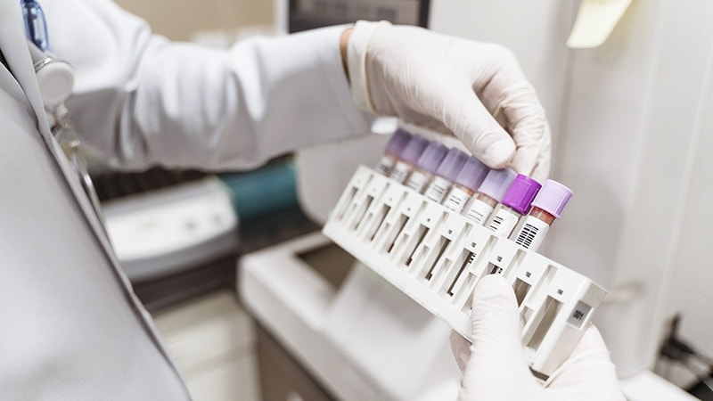 High Salivary Aldosterone Can Signal Future Heart Disease