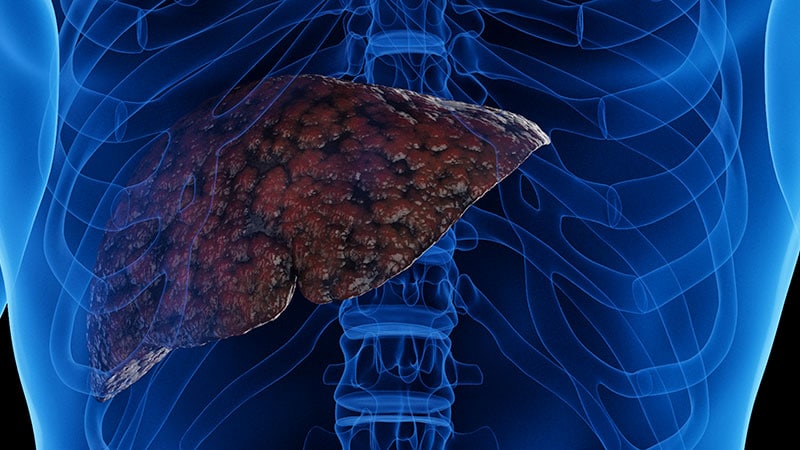 First GLP-1 Backed for MASH in Europe