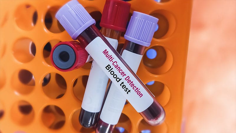 Multicancer Tests: Has the Reality Lived Up to the Hype?