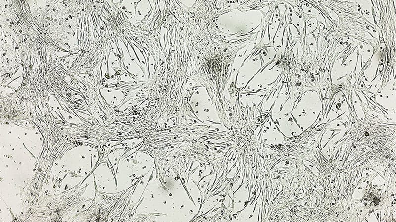 Q&A: AMA President’s Health Crisis Informs View of US System