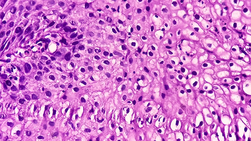 Response to RSV Varies With Age