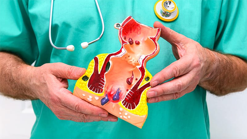 Perianal Abscess Tied to Crohn's Disease Risk in Older Kids