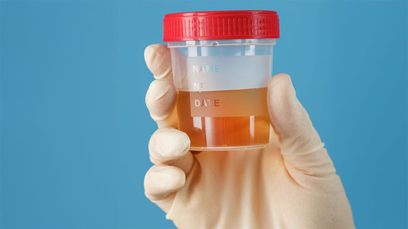 Urine Culture Can Speed Urosepsis Pathogen Detection
