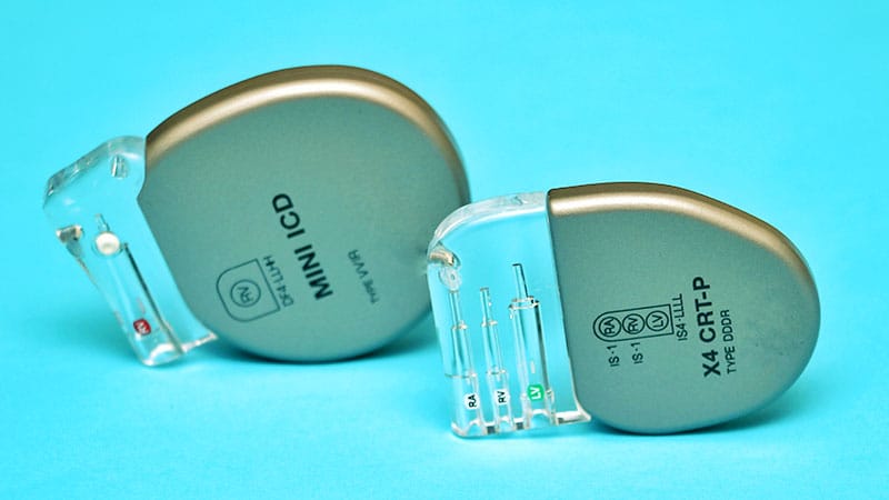 CSP vs BiV Pacing Trials Show Inconsistent Results