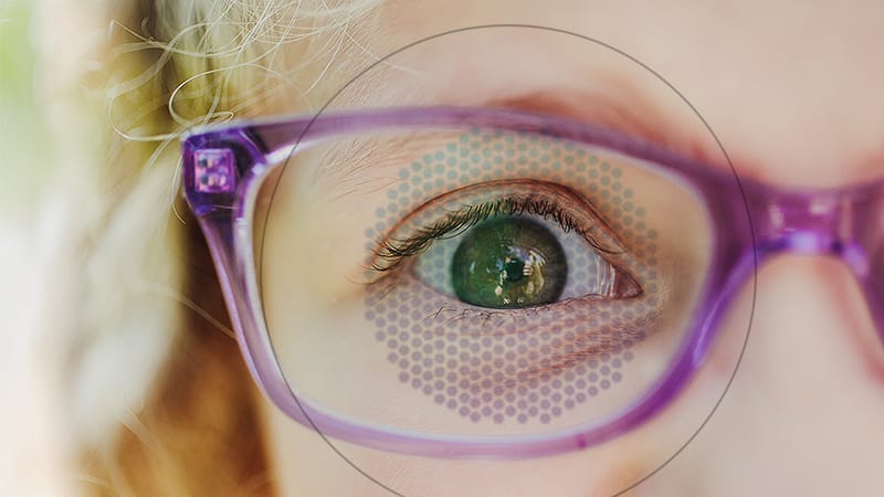 Myopia Numbers Are Rising. Our Response Should Be Too