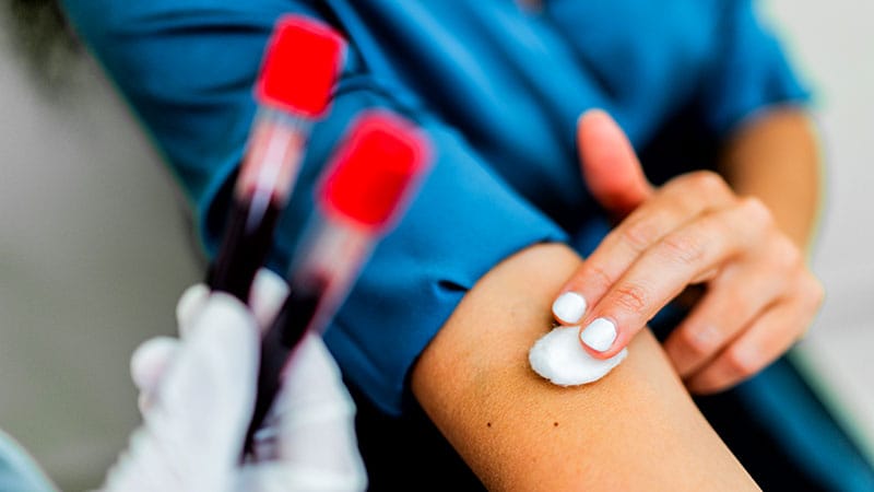 A Blood Test for Colon Cancer Screening? Not So Fast!