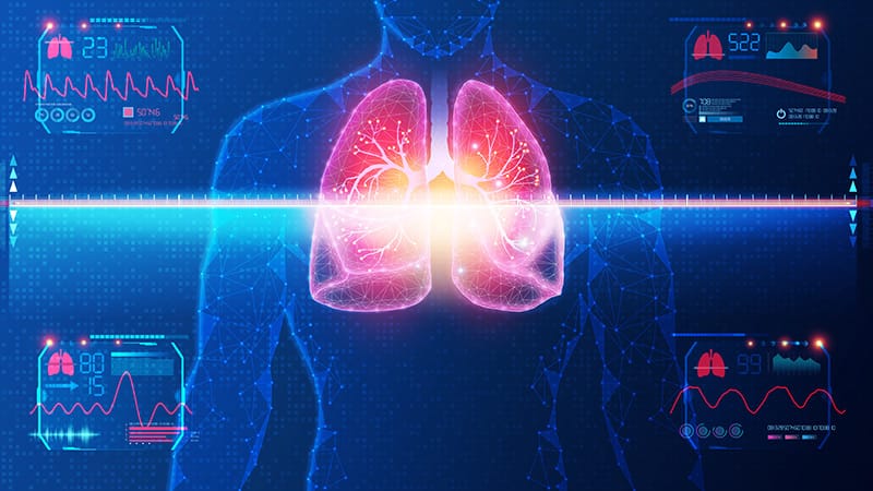 Where AI Is Leading and Lagging in Pulmonary and Critical Care