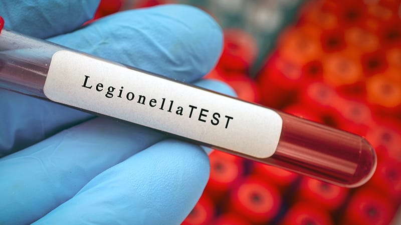 Simplified Score Improves Legionella Detection