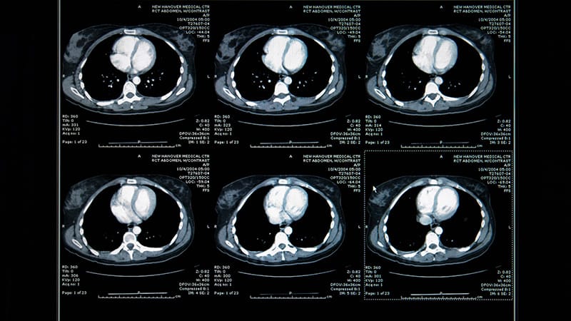 AI Tool Flags Six Acute Abdominal Emergencies on CT