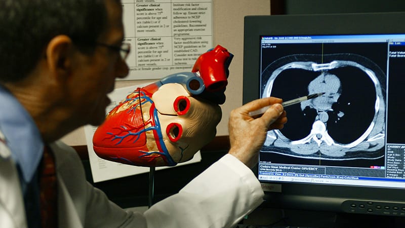 Simplified Risk Score Predicts Coronary Calcium on CTA - Medscape