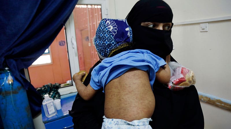 Is Measles in Yemen a Threat to the Broader Region?