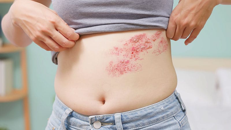 www.medscape.com