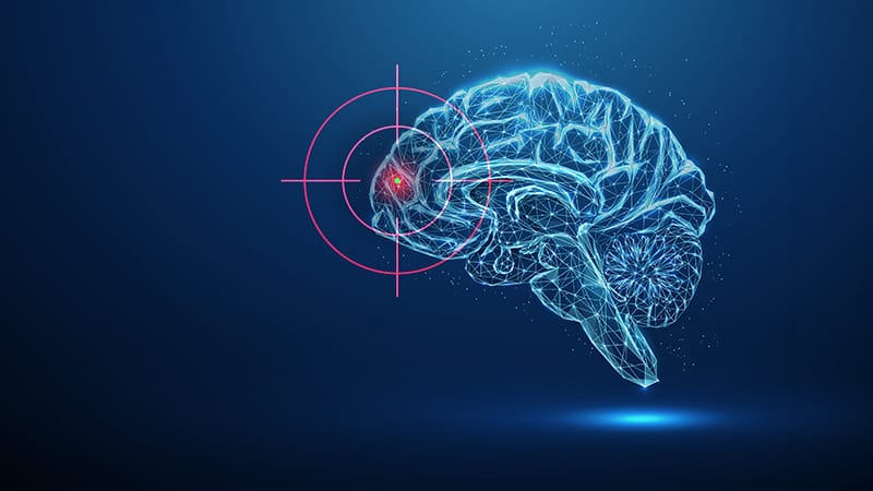 Medscape.com: New Migraine Targets and Treatments for Clinical Practice