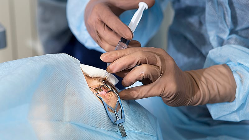 Study Shows Potential of Omitting Speculum in Eye Injections