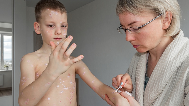 Meta-Analysis Examines Omalizumab for Urticaria in Children