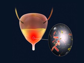 photo of Bacterial cystitis, illustration